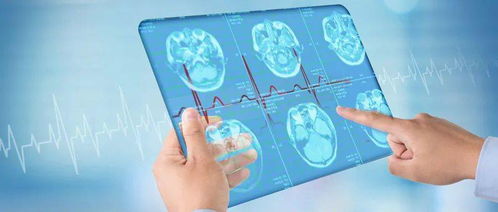 华为云助力内蒙古自治区医疗保障信息平台建设，全面提升群众医保服务体验